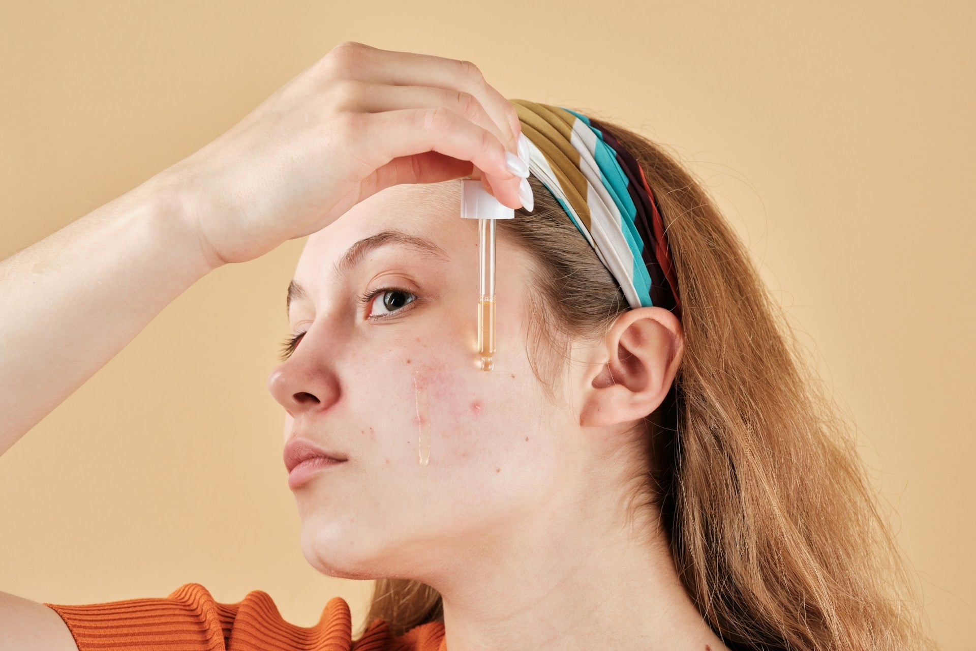 Preventing Acne Breakouts